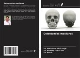Osteotomías maxilares Osteotomías maxilares