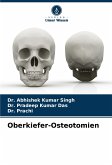 Oberkiefer-Osteotomien Oberkiefer-Osteotomien