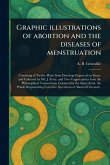 Graphic Illustrations of Abortion and the Diseases of Menstruation Graphic Illustrations of Abortion and the Diseases of Menstruation