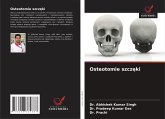 Osteotomie szcz¿ki Osteotomie szcz¿ki