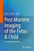 Post Mortem Imaging of the Fetus & Child (eBook, PDF)