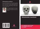 Osteotomias maxilares Osteotomias maxilares