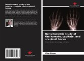 Densitometric study of the hamate, capitate, and scaphoid bones Densitometric study of the hamate, capitate, and scaphoid bones