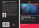 Escore de risco ecocardiográfico após SCA Escore de risco ecocardiográfico após SCA