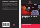 Imunoterapia do cancro do pulmão Imunoterapia do cancro do pulmão