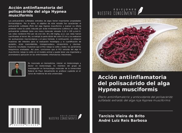 Acción antiinflamatoria del polisacárido del alga Hypnea musciformis