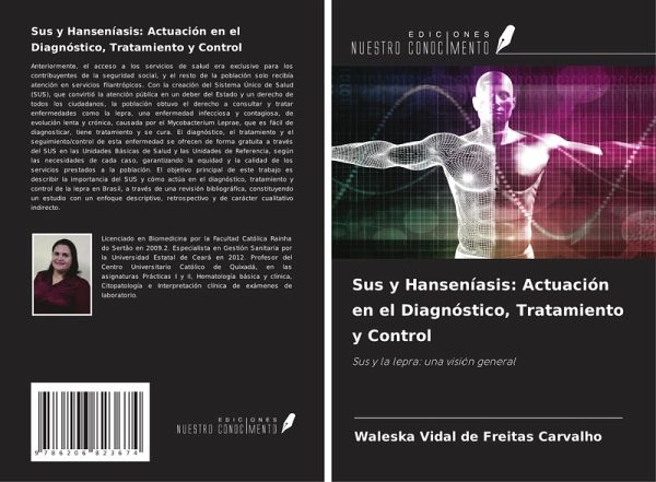 Sus y Hanseníasis: Actuación en el Diagnóstico, Tratamiento y Control