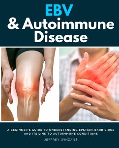 Cover EBV & Autoimmune Disease (eBook, ePUB)