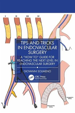 Tips and Tricks in Endovascular Surgery - Solimeno, Giovanni