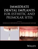 Immediate Dental Implants for Esthetic and Premolar Sites (eBook, PDF)