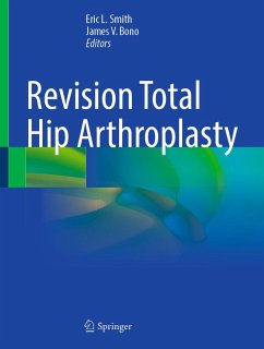 Revision Total Hip Arthroplasty (eBook, PDF)