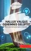 HALLUX VALGUS GEHEIMNIS GELÜFTET - Nimm deine Schmerzen selbst in die Hand (eBook, ePUB) HALLUX VALGUS GEHEIMNIS GELÜFTET - Nimm deine Schmerzen selbst in die Hand (eBook, ePUB)