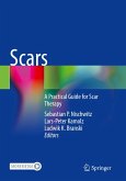 Scars Scars