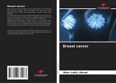 Breast cancer Breast cancer