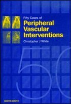 Cover Fifty Cases of Peripheral Vascular Interventions