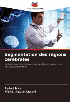 Segmentation des régions cérébrales - Naz, Rahat;Ansari, Mohd. Aquib