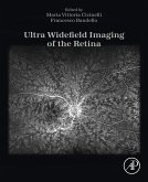 Ultra Widefield Imaging of the Retina (eBook, ePUB)