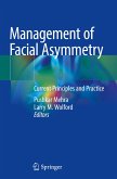 Management of Facial Asymmetry Management of Facial Asymmetry