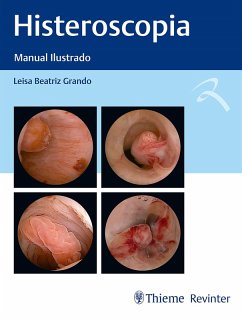 Cover Histeroscopia (eBook, ePUB)