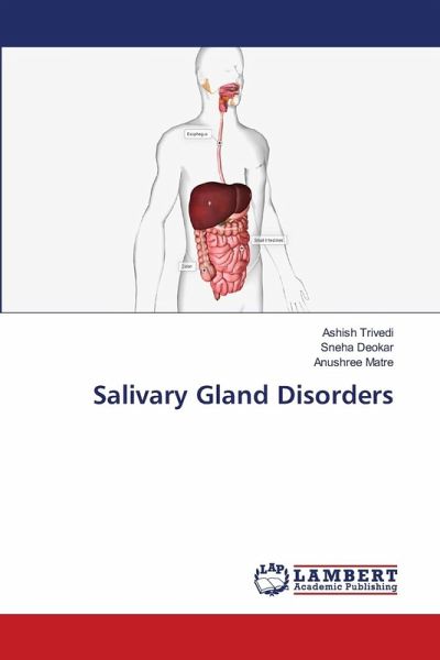 Salivary Gland Disorders