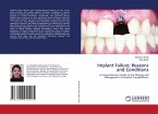 Implant Failure: Reasons and Conditions
