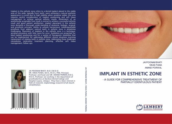 IMPLANT IN ESTHETIC ZONE IMPLANT IN ESTHETIC ZONE