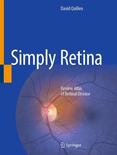 Simply Retina (eBook, PDF) - Quillen, David