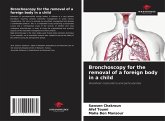 Bronchoscopy for the removal of a foreign body in a child