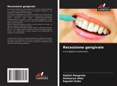 Cover Recessione gengivale