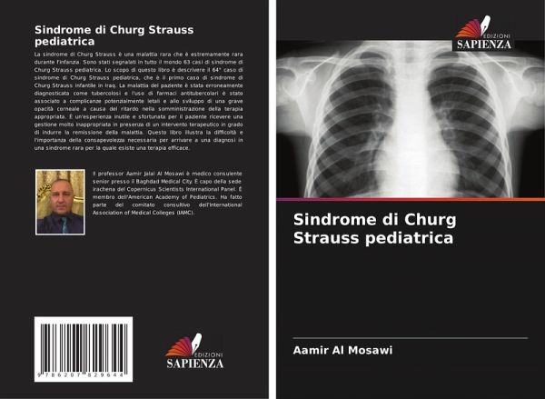 Sindrome di Churg Strauss pediatrica Sindrome di Churg Strauss pediatrica