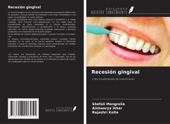 Cover Recesión gingival