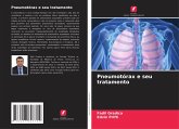 Pneumotórax e seu tratamento Pneumotórax e seu tratamento