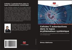 Cellules T autoréactives dans le lupus érythémateux systémique - Abdirama, Dimas