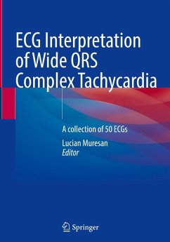 Cover ECG Interpretation of Wide QRS Complex Tachycardia