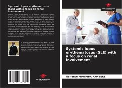 Cover Systemic lupus erythematosus (SLE) with a focus on renal involvement