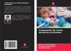 Tratamento de cáries dentárias profundas Tratamento de cáries dentárias profundas