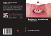 Gestion des implants mal positionnés