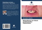 Behandlung von falsch positionierten Implantaten