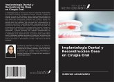 Implantología Dental y Reconstrucción Ósea en Cirugía Oral Implantología Dental y Reconstrucción Ósea en Cirugía Oral