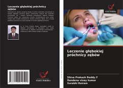 Cover Leczenie g¿¿bokiej próchnicy z¿bów