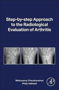 Radiological Eval of Arthritis - Chandramohan, Muthusamy; Helliwell, Philip
