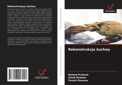 Cover Rekonstrukcja ¿uchwy