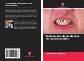 Tratamento de implantes mal posicionados