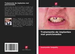 Tratamento de implantes mal posicionados - Satpathy, Soumyadev