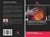CANCRO DO ESTÔMAGO
