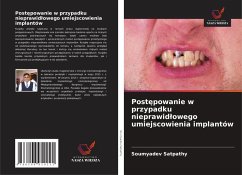 Post¿powanie w przypadku nieprawid¿owego umiejscowienia implantów - Satpathy, Soumyadev