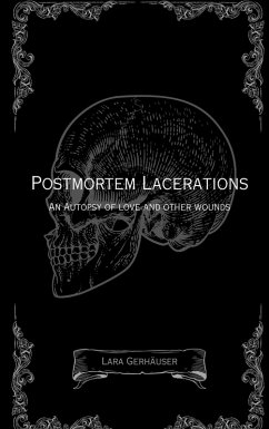 Postmortem Lacerations Postmortem Lacerations