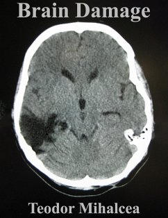 Brain Damage (eBook, ePUB) - Mihalcea, Teodor