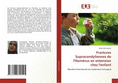 Fractures Supracondyliennes de l'Humérus en extension chez l'enfant - Boumezber, Nabila