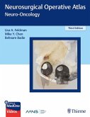 Neurosurgical Operative Atlas: Neuro-Oncology (eBook, ePUB)